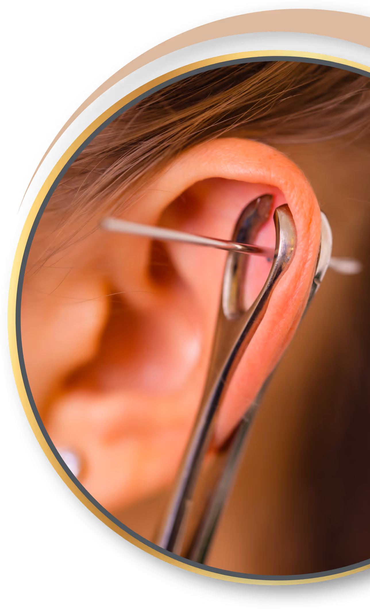 Akupunktur Piercing von Nadelkust für Hürtgenwald