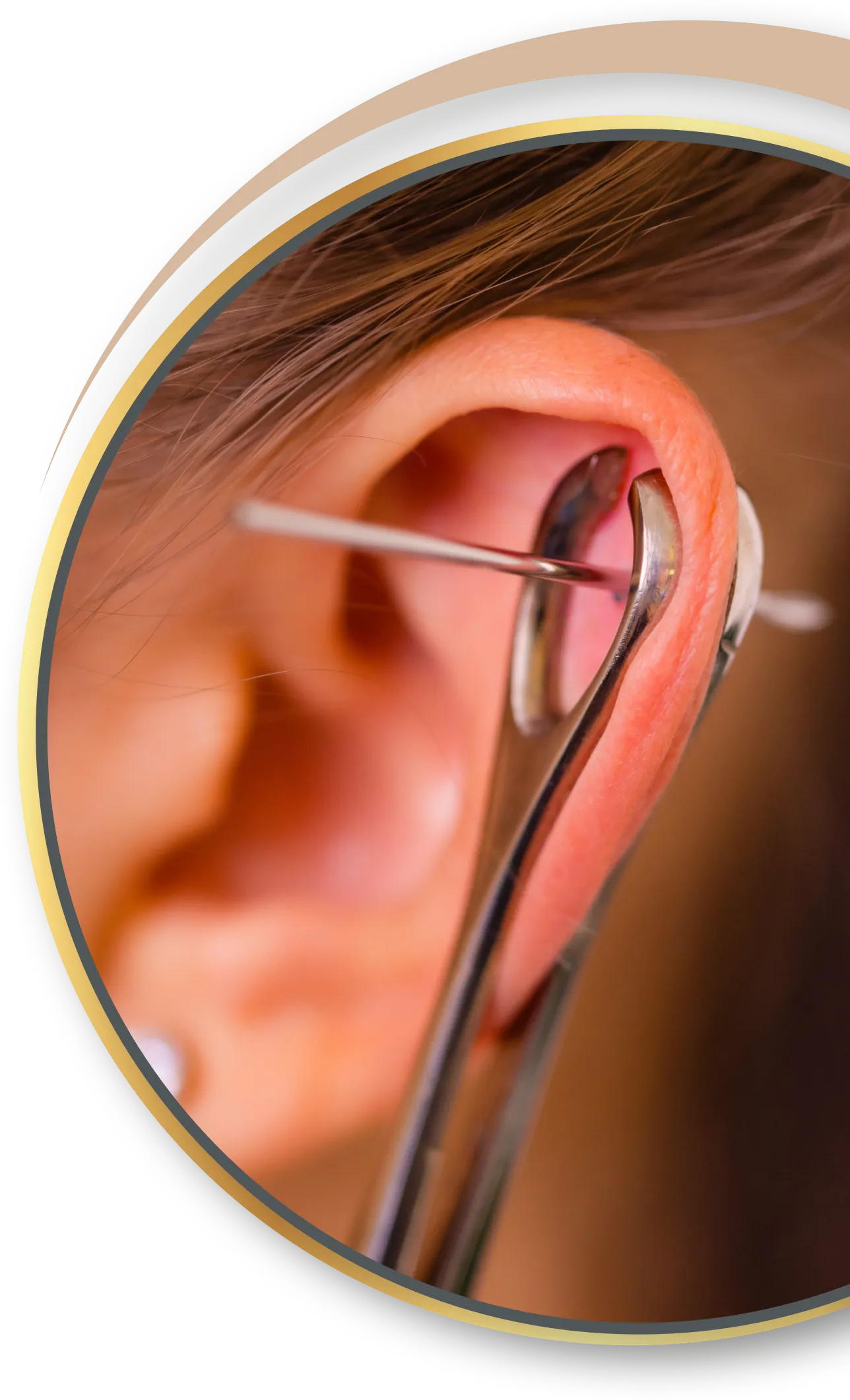 Akupunktur Piercing von Nadelkust für Übach-Palenberg